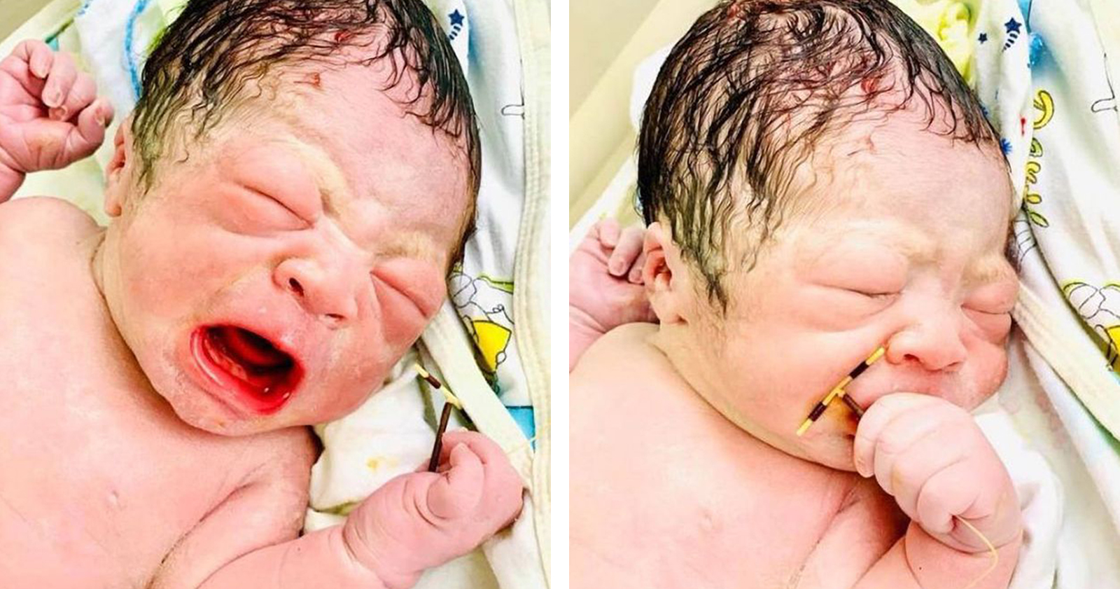 Au Vietnam Un Bebe Est Ne En Tenant Le Sterilet De Sa Mere Dans La Main